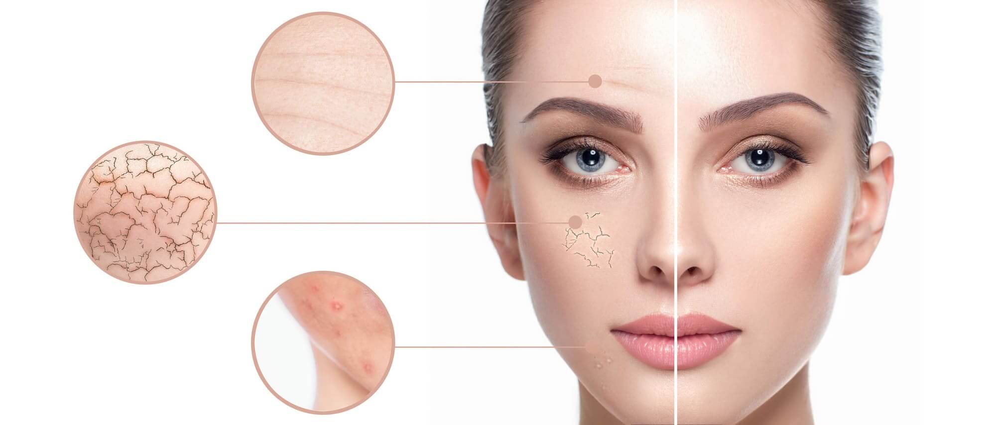 collagen the ultimate skin ally